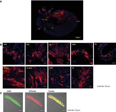 Pnmt-Derived Cardiomyocytes: Anatomical Localization, Function and Future Perspectives